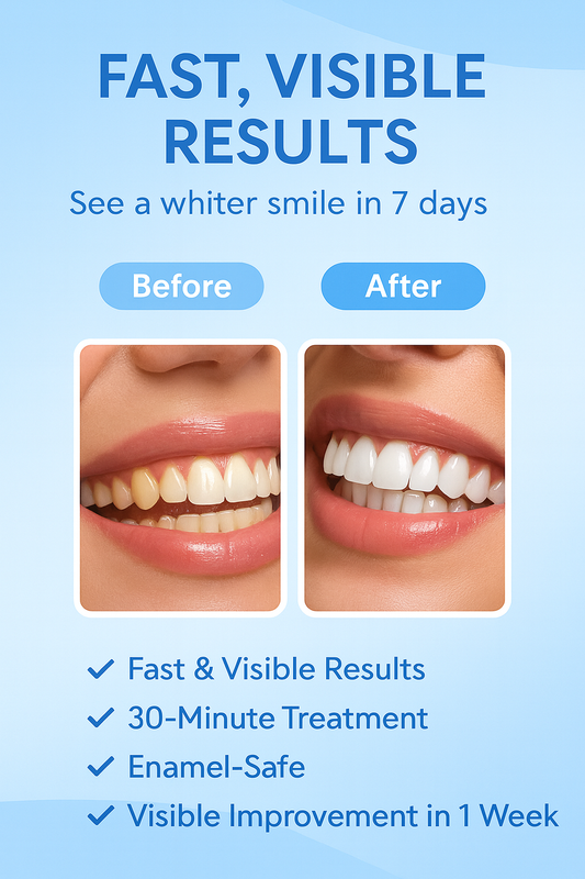 NoirLuxe Teeth Whitening Strips